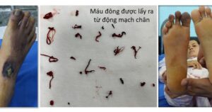 cuu duoc ca benh hiem ngheo sap dua ve que buong xuoi theo so phan 655777df9b96d