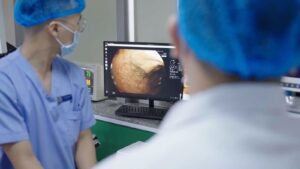 vinbrain trinh lang draid endoai giai phap ai cho noi soi tieu hoa 6747c7019d12e