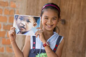 trien khai chien dich quyen gop dam bay ho tro phau thuat cho tre em viet nam 67e206be171db